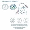 664f4604a9ce170cd4473643.jpg