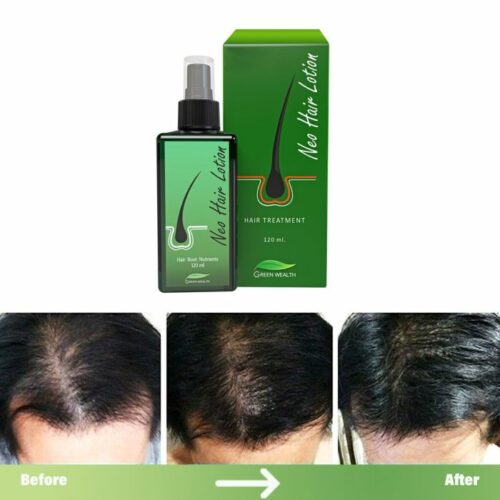 Green-Wealth-Neo-Hair-Lotion-120ml-1.jpg
