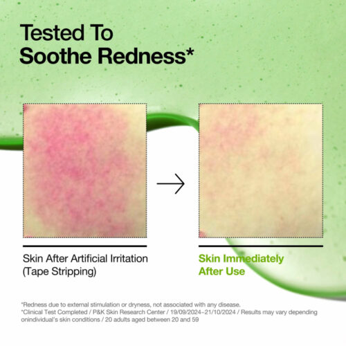 anua-us-ampoule-serum-azelaic-acid-10-hyaluron-redness-soothing-serum-1161173133.jpg