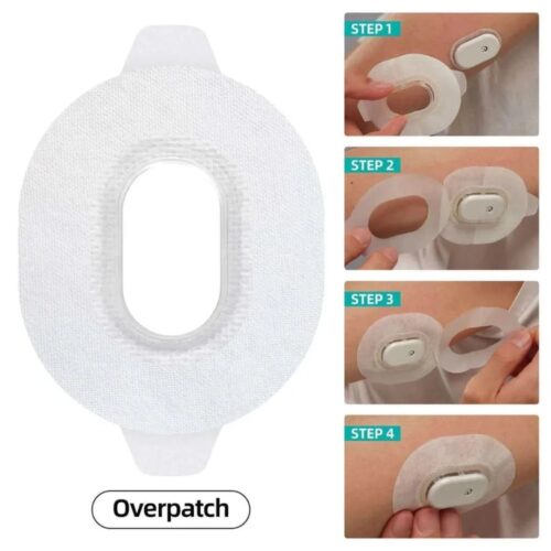 over_patch-186794_1_